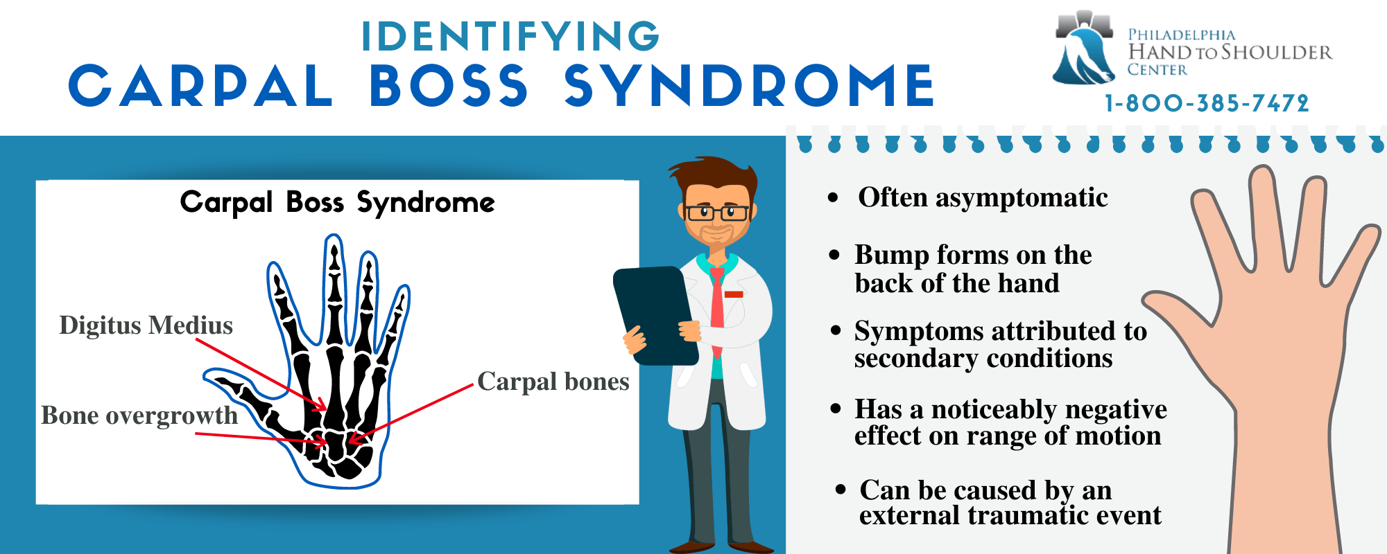 What Is Carpal Boss Syndrome And How Is It Treated 